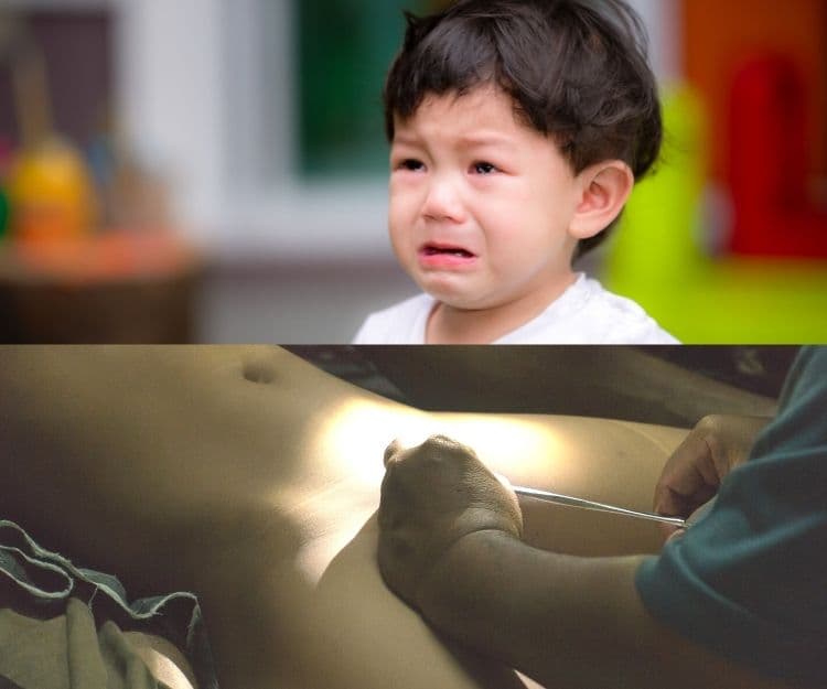 男童包皮過長點處理？如何決定是否要做手術？｜外科專科醫生劉湛益